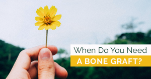 Read more about the article When do You Need a Bone Graft?
